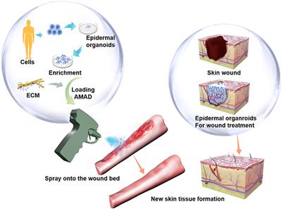 Auto Micro Atomization Delivery of Human Epidermal Organoids Improves Therapeutic Effects for Skin Wound Healing